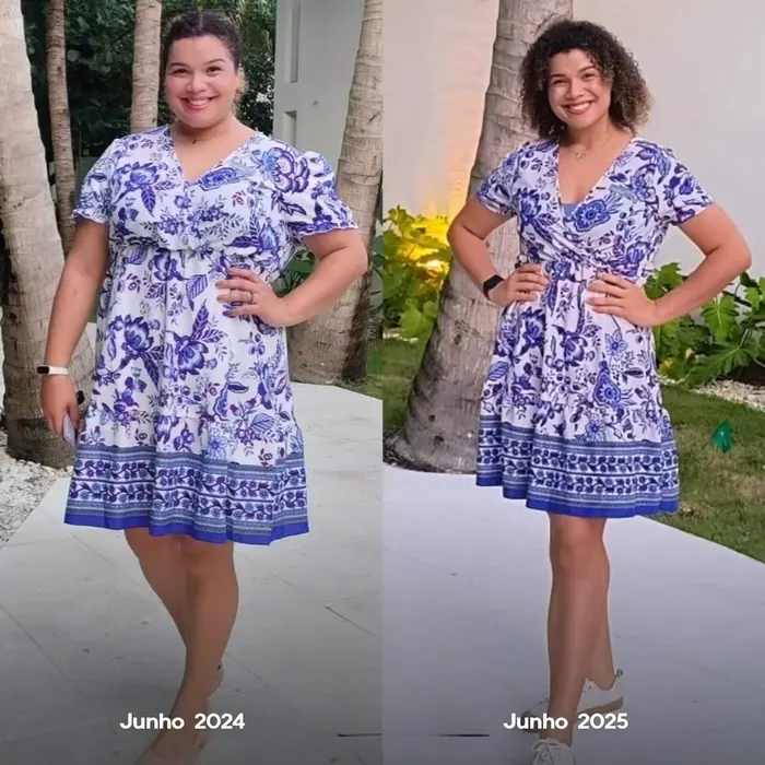 Antes e depois de paciente do Instituto Nogueira