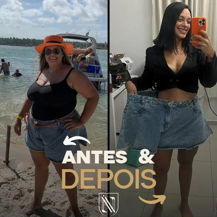 Antes e depois de paciente do Instituto Nogueira