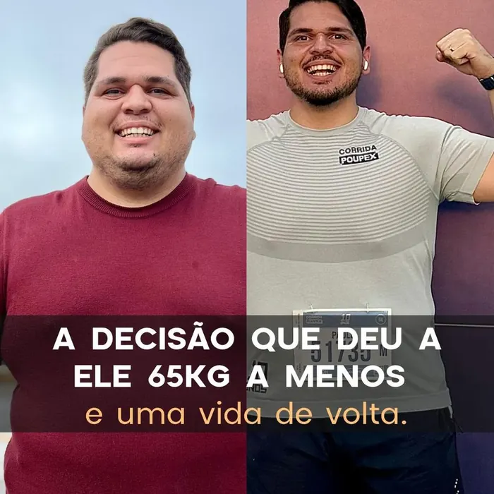 Antes e depois de paciente do Instituto Nogueira
