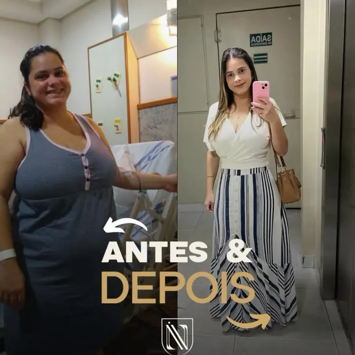 Antes e depois de paciente do Instituto Nogueira