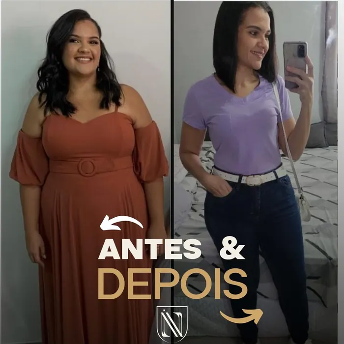 Antes e depois de paciente do Instituto Nogueira