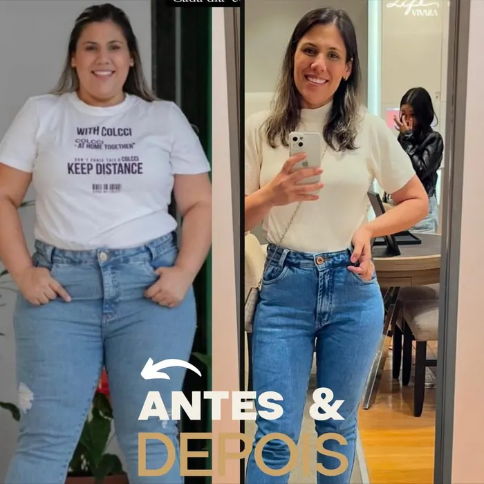 Antes e depois de paciente do Instituto Nogueira