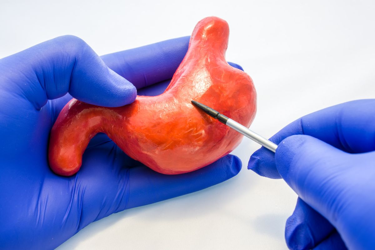 pos-cirurgia bariatrica